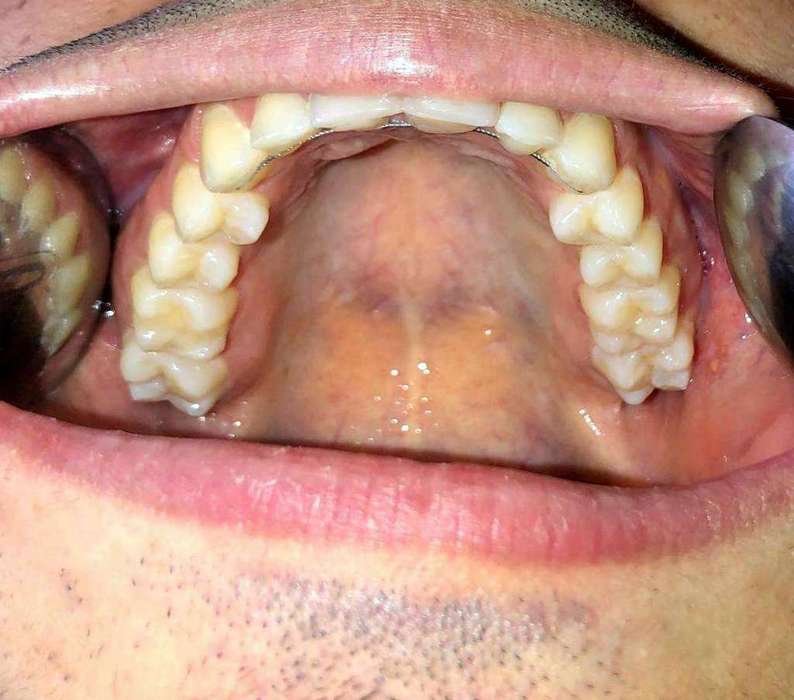 Remote Orthodontic Consultations Dublin Orthodontics